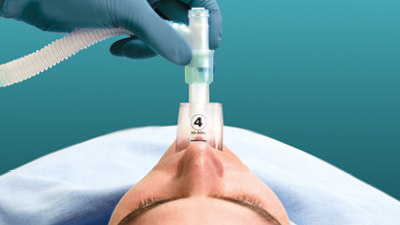 Gestión de vías aéreas