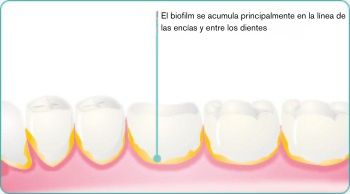 ES-explore-image-oral-care-vap-facts-2