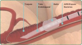 ES-explore-image-oral-care-vap-facts-3